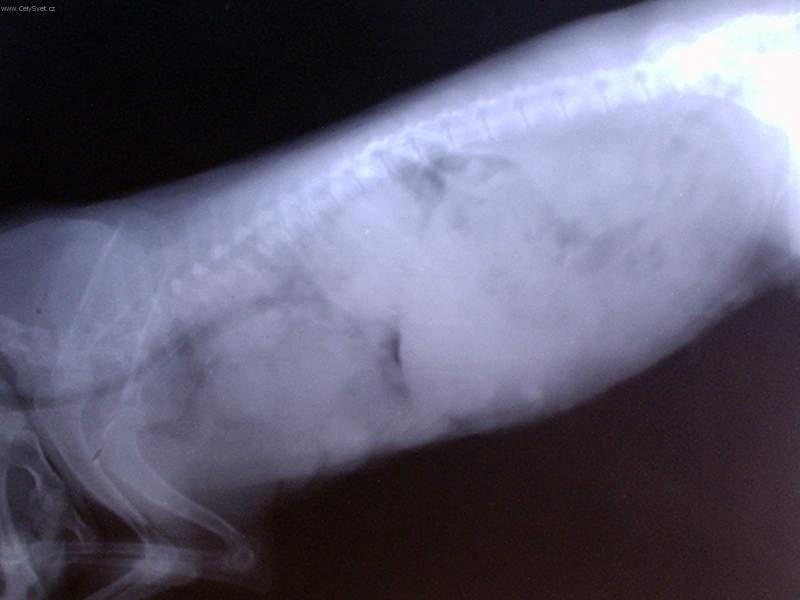 Fotky: Onkologie - Novotvary ml��n� �l�zy u fen (foto, obrazky)